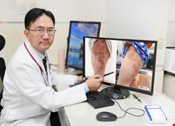 異位性皮膚炎新療法 生物製劑助孩童擺脫長期紅疹與搔癢